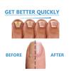Многофункциональные наклейки для ухода за ногтями, уход за поврежденными ногтями, эффективно улучшают внешний вид поврежденных ногтей на руках и ногах