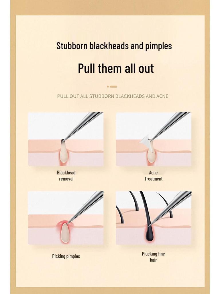Stainless Steel Ultra-Sharp Blackhead & Acne Tweezers Set: Three-Piece Pimple Removal Tools