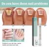 Nail TreatmentPen, Nail Cuticle Oil, Damaged Nail Pen, Nail Strengthening CuticleSwitch, AloeVera And TeaTree Oil RepairDamaged,3ml