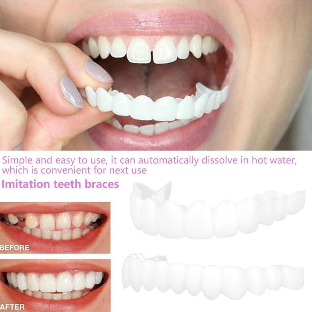 1 Pair Teeth Veneers Men Women Brightening Dentures Temporary False Teeth Cover Instant Imitation Braces For Confidence Smile