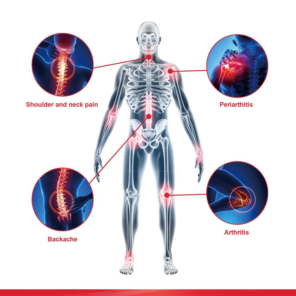 South Moon Крем для снятия боли с конским каштаном, облегчение боли в шее, облегчение боли в суставах, грыжа межпозвоночного диска, крем для коленного сустава
