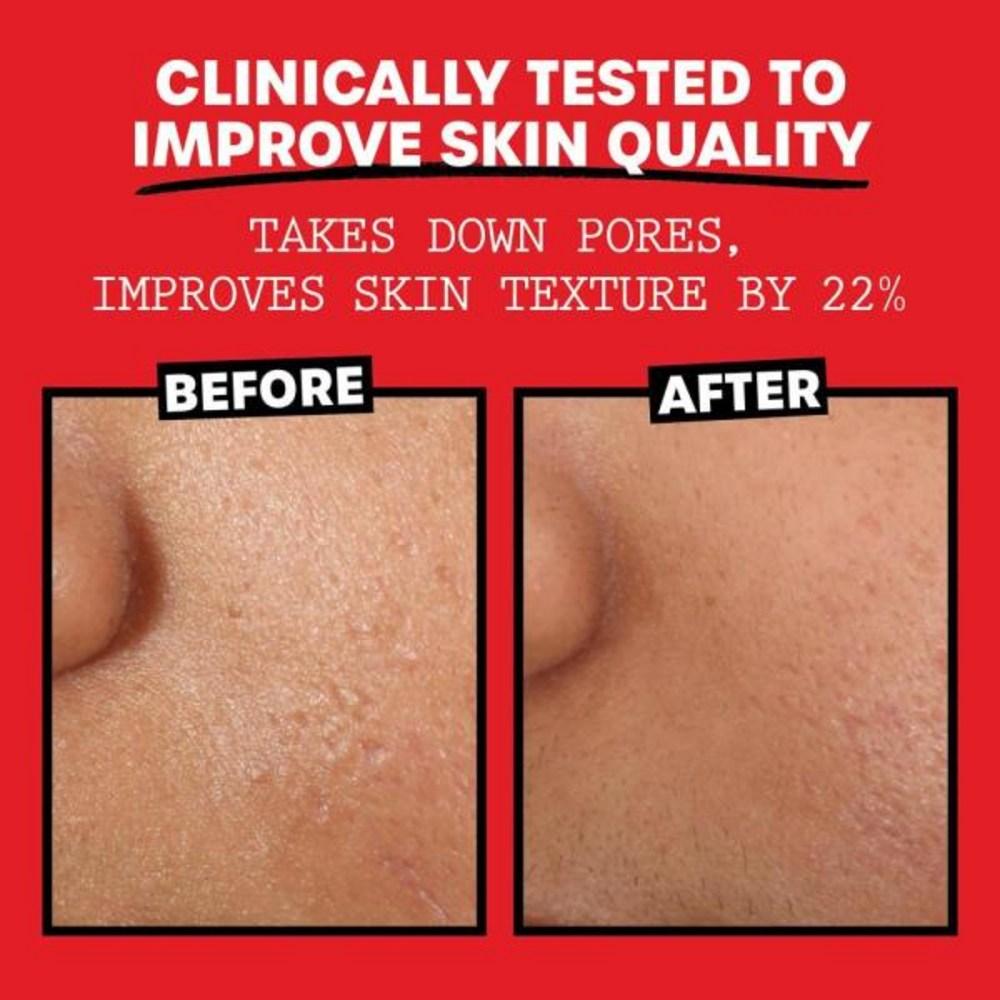 THAYERS Witch Hazel Lavndr Alcfre Прозрачный 300 мл, 1) Упаковка 12 жидких унций (1 шт.)