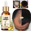 Hair Oil, Hair Growth For Hair Loss, Deep Moisturizing For Dry, Damaged & Coarse Hair.20ml