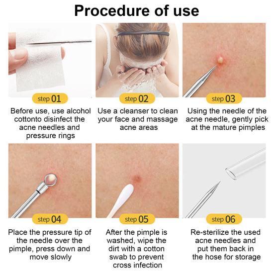 Набор из 7 инструментов для удаления черных точек из нержавеющей стали, набор игл для удаления черных точек на лице, носу, акне, для устранения пятен, набор для выдавливания белых угрей