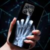 For TCL 20 Pro 5G Cases Fashion Soft TPU Silicone Back Covers for TCL 20Pro 5G Back Case Cartoon Cat Coque Bumper TCL20Pro T810H