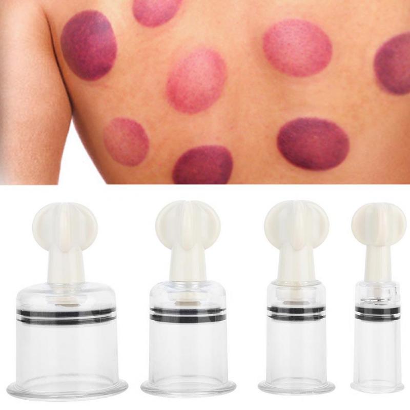 Вакуумные банки, акупунктурный массажер, облегчение боли, здравоохранение, банки