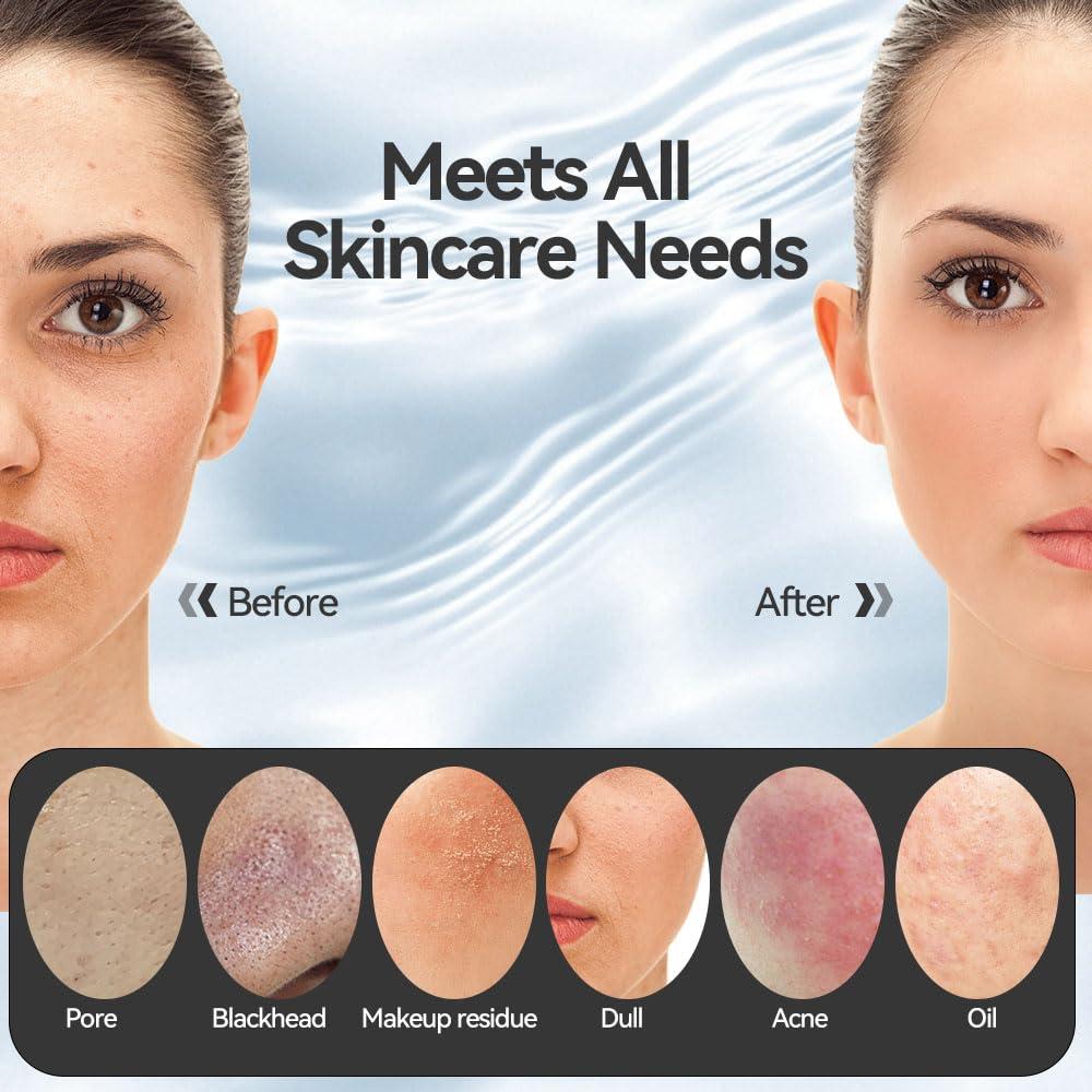 Щетка для умывания лица, Силиконовый скрабер для лица с нагревом и вибрацией, 5 скоростей, Водонепроницаемая перезаряжаемая электрическая щетка для скрабирования лица