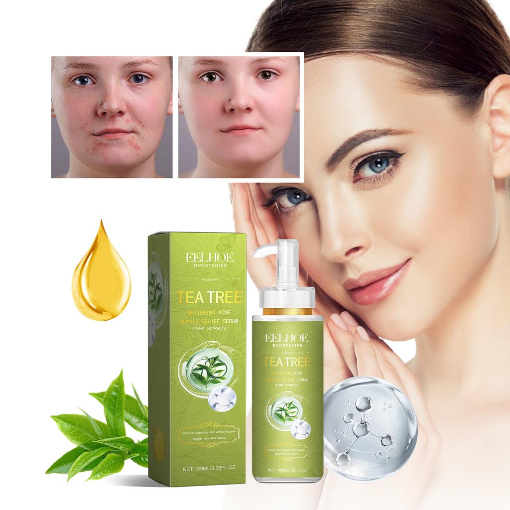 Eelhoe Tea Tree Anti-acne Essence Reduces Acne Pimples Fine Lines Clears Skin Tightens Pores And Moisturizes Skin Essence