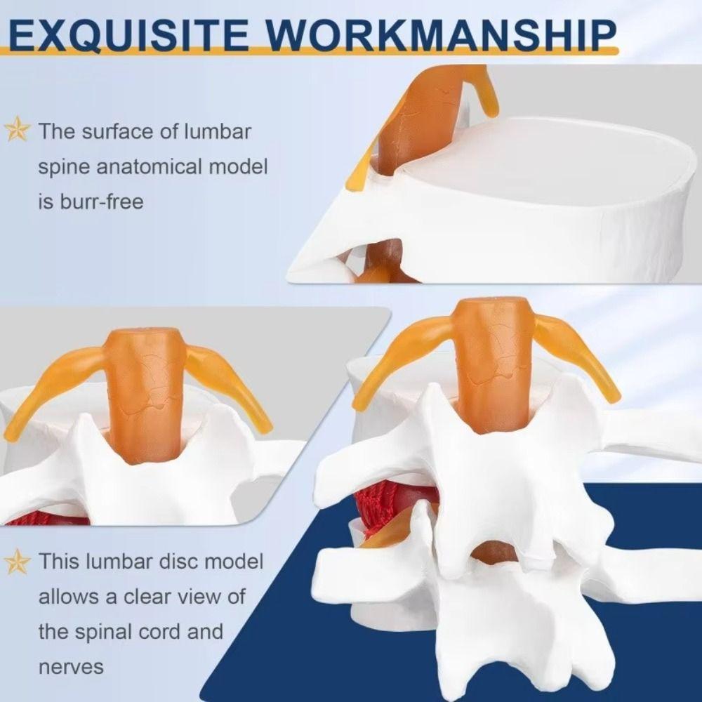 3D Model Lumbar Model 1.5X Enlarge Lumbar Disc Herniation Teaching Tool Nursing