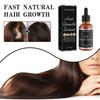 Hair Care Hair Growth Essential Oils Essence Prevent Hair Loss Liquid Health Care Beauty Dense Hair Growth Serum