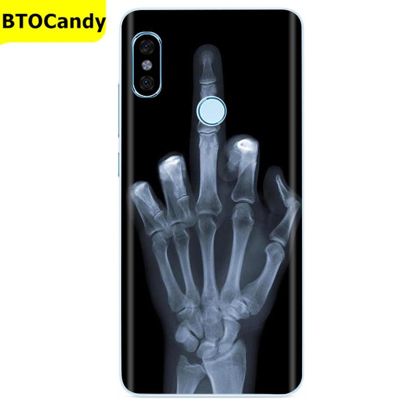 Силиконовый чехол для Xiaomi Redmi Note 5, милый чехол из ТПУ, чехол для телефона Xiomi Xiaomi Redmi Note 5 Pro/Redmi Note5, сумки Fundas