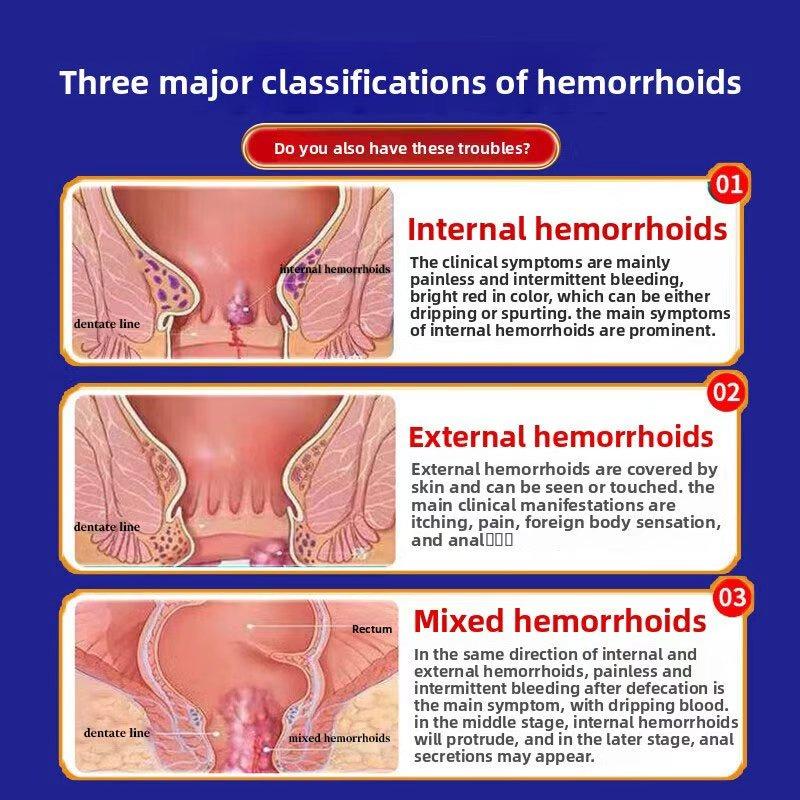 Успокаивающий крем для облегчения боли при иссечении прямой кишки, внутреннем геморрое и наружном геморрое, смешанном геморрое
