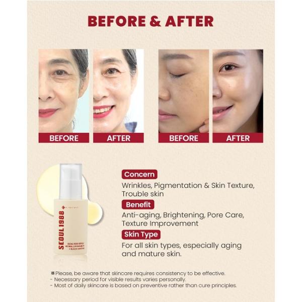 K-SECRET Сыворотка СЕУЛ 1988 : Ретинальные липосомы 2% + Черный женьшень 30мл