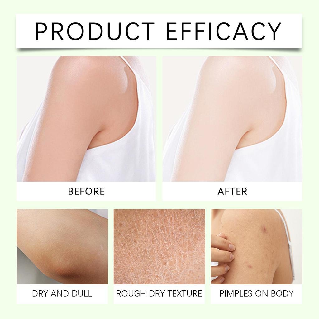 Увлажняющее средство для тела Масло ши Питательный Увлажняющий Лосьон для тела Успокаивающий Восстанавливающий Кожа тела