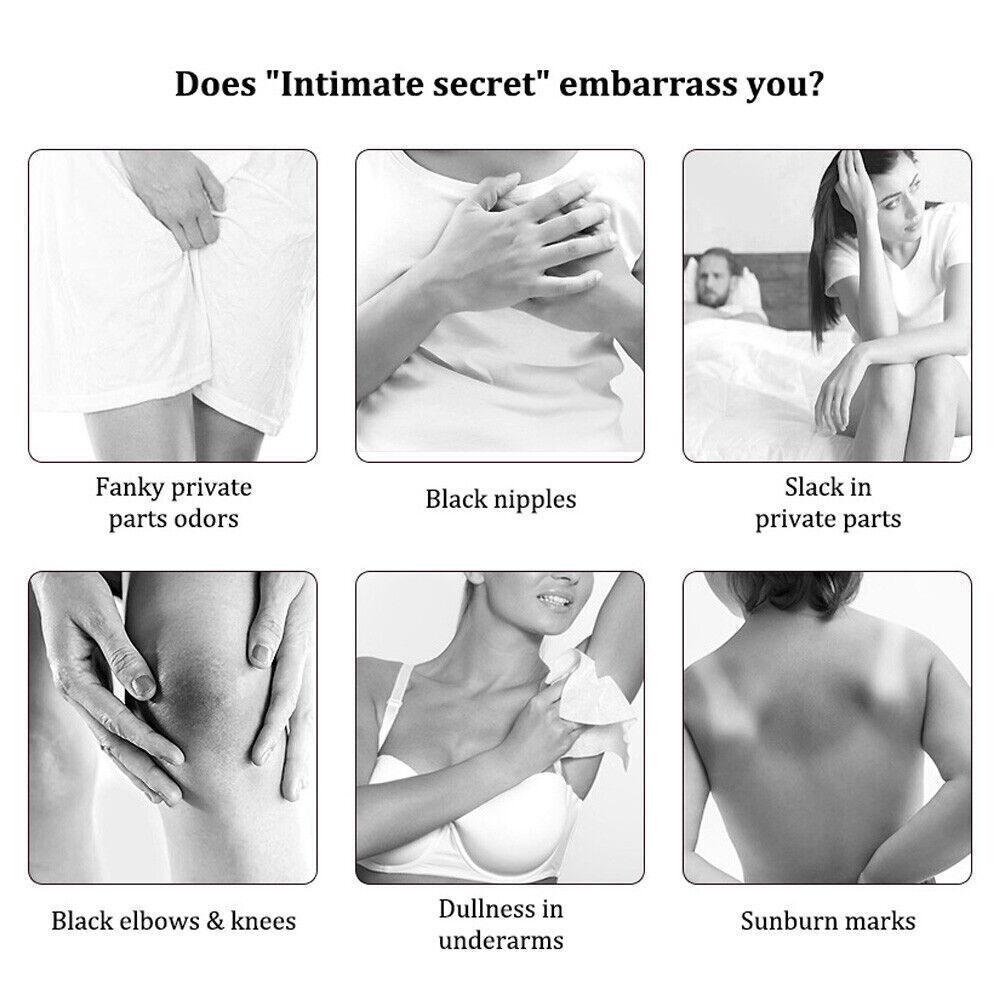 Новый Отбеливающий Крем для Тела Осветляет Подмышки Локти Интимные Суставы Темные Удаляет 30 мл J4Z3