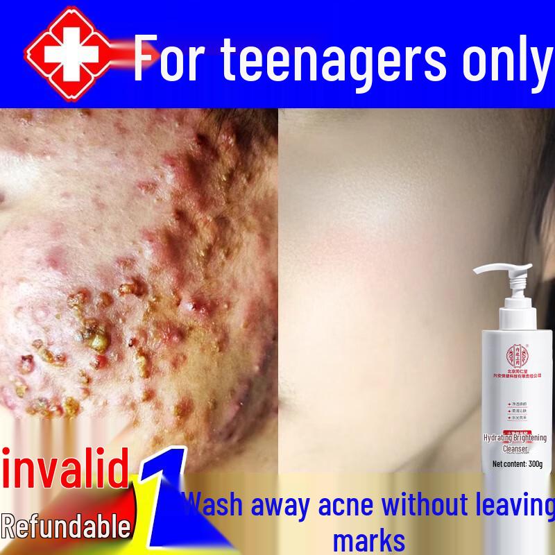 Tong Ren Tang Acne Clearing Amino Acid Facial Cleanser