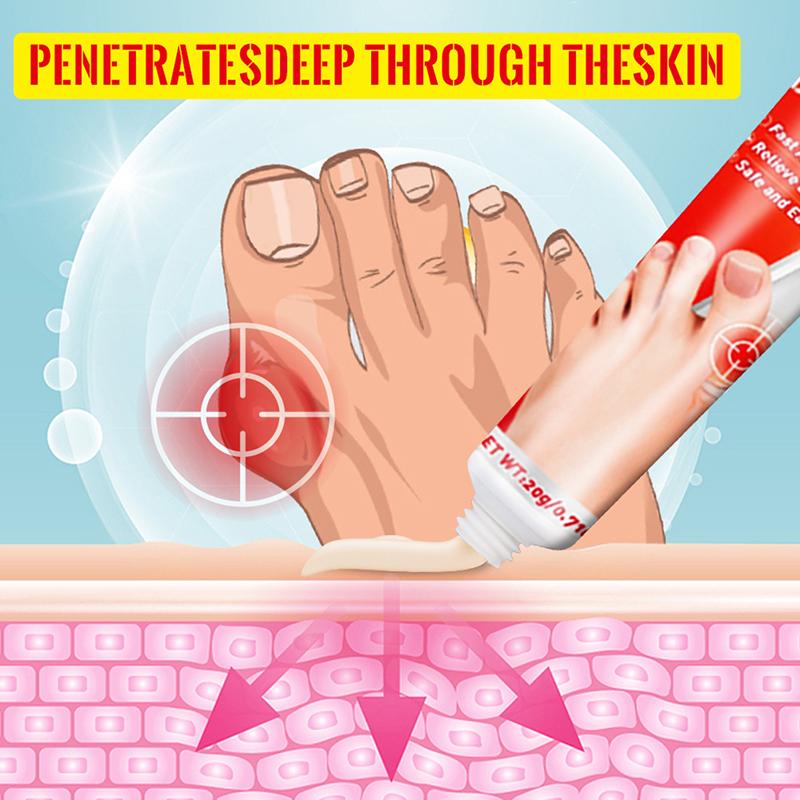 Мазь 20 г для облегчения боли при бурсите и подагре, крем-корректор вальгусной деформации большого пальца ноги, крем для лечения артрита большого пальца ноги, колена и поясницы