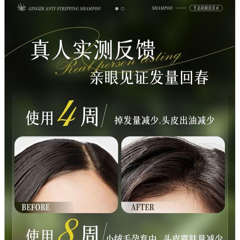ZOOLY - No.1 Anti Hair Loss Scalp Care Shampoo - 2 Sizes