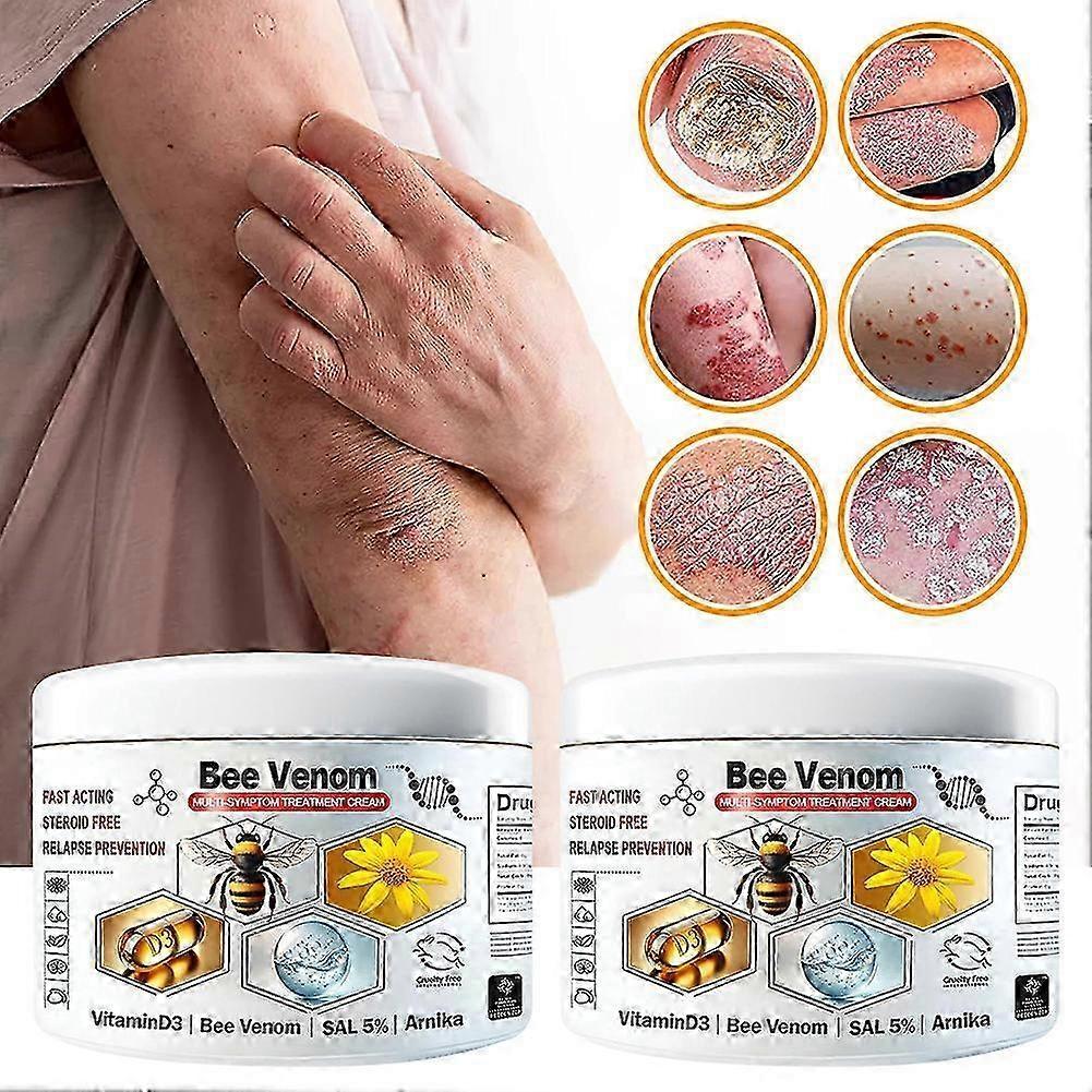 Bee-venom Multi-symptom Skin Treatments Cream, Portable Anti-itch Care For All Skin Types