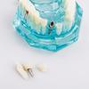Dental Study Tooth Transparent Adult Pathological Teeth Model