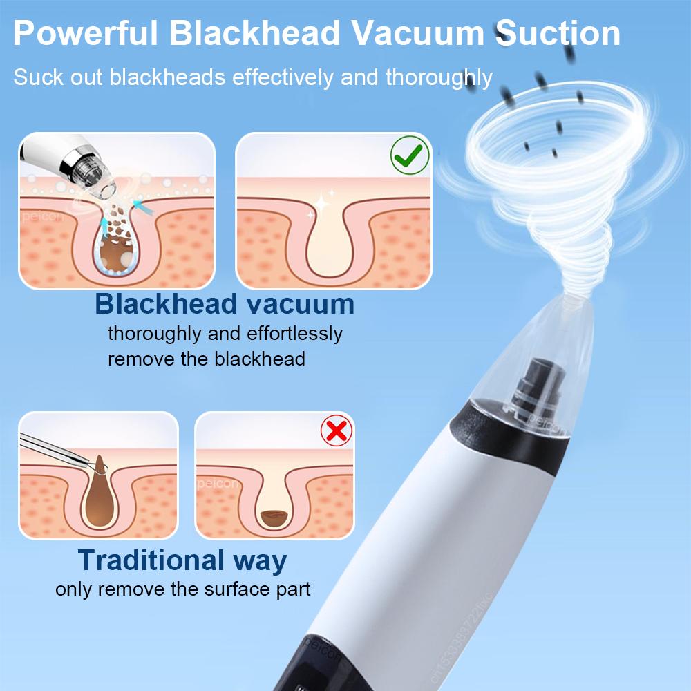 Blackhead Remover Pore Cleaner Black Dots Remover Electric Black Point Extractor Pimple Acne Blackhead Black Dots Vacuum Cleaner