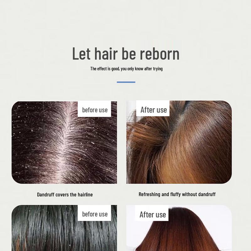 Longrich Refreshing Anti-Dandruff Shampoo