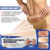 South Moon Самоклеящийся силиконовый пластырь для рубцов, восстанавливающий ожоговые рубцы, разглаживающий кожу, пластырь для ухода за ранами
