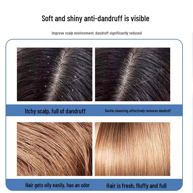 100 Years Runfa Anti-Dandruff & Softening Shampoo