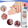 Exstroyeza Pen FUNGAL NAIL PEN Масло для ногтей 5 мл