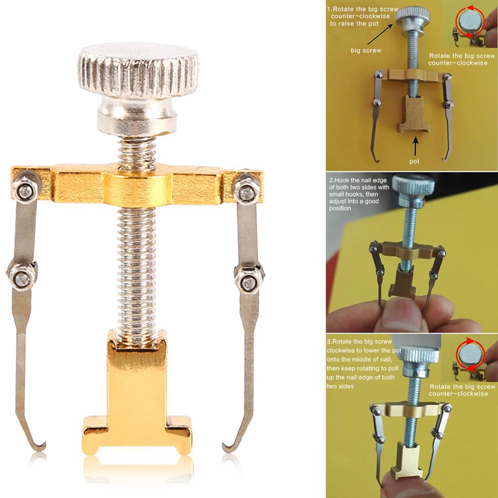 Профессиональный инструмент для восстановления и коррекции вросшего ногтя, фиксатор, маникюр, педикюр, уход за ногтями