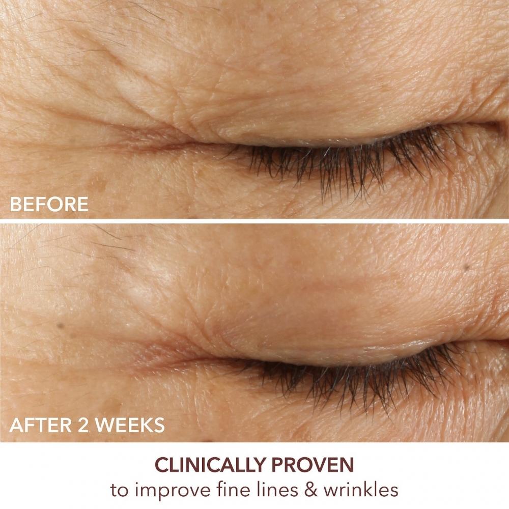 Доктор. Dennis Gross Skincare Advanced Retinol + Ferulic Тройная корректирующая сыворотка для глаз