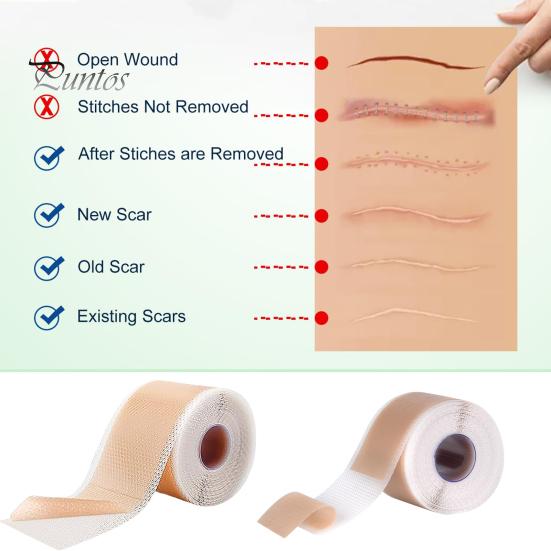 Силиконовые пластыри для рубцов, рулон ленты для рубцов, профессиональные мягкие полоски для рубцов после хирургических операций, келоидные рубцы, лечение угревой сыпи, силиконовый гелевый пластырь