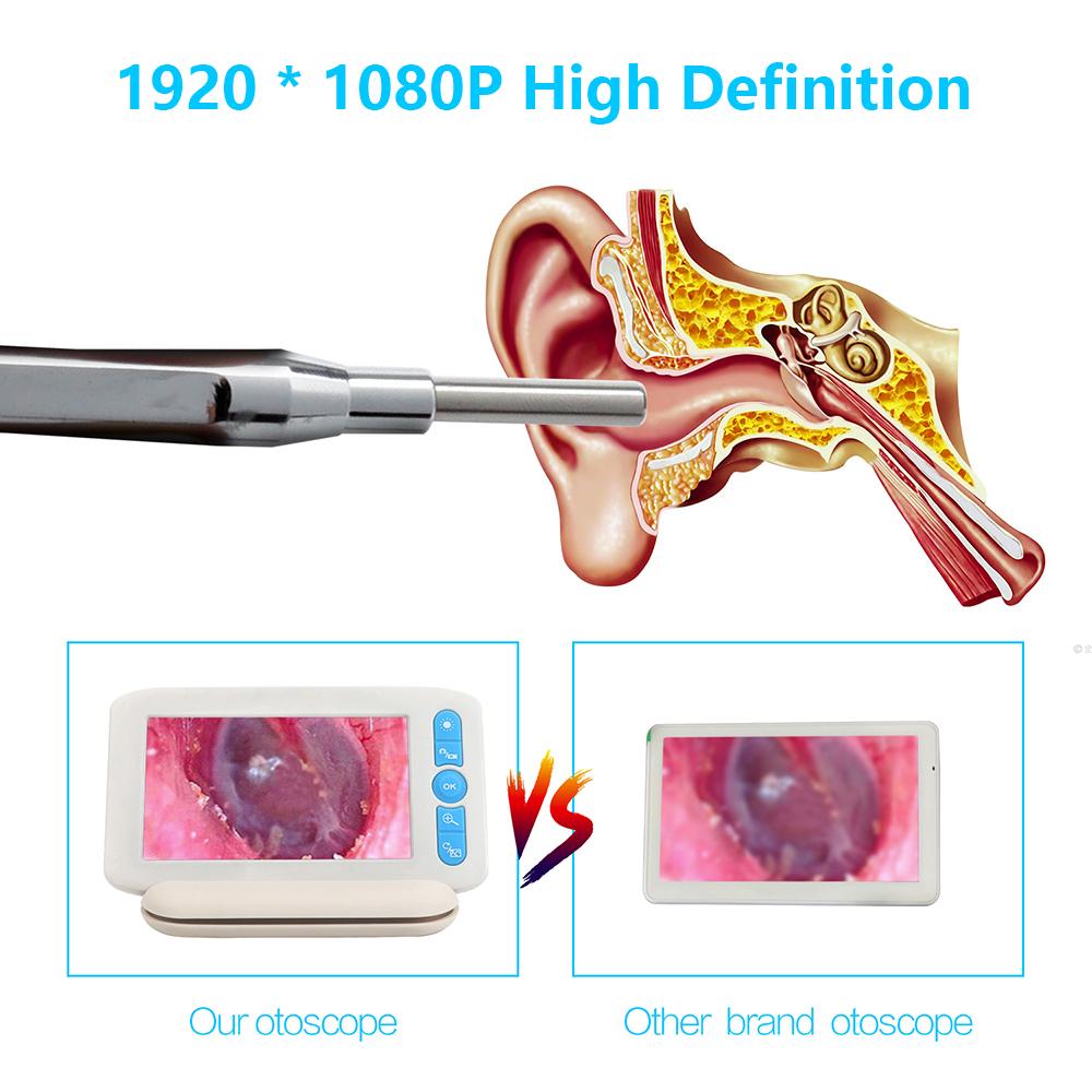 Цифровой отоскоп с 6 светодиодами, 32G TFcard, 3,9 мм, 1080P, камера для наблюдения за ушами, 4,3 дюйма