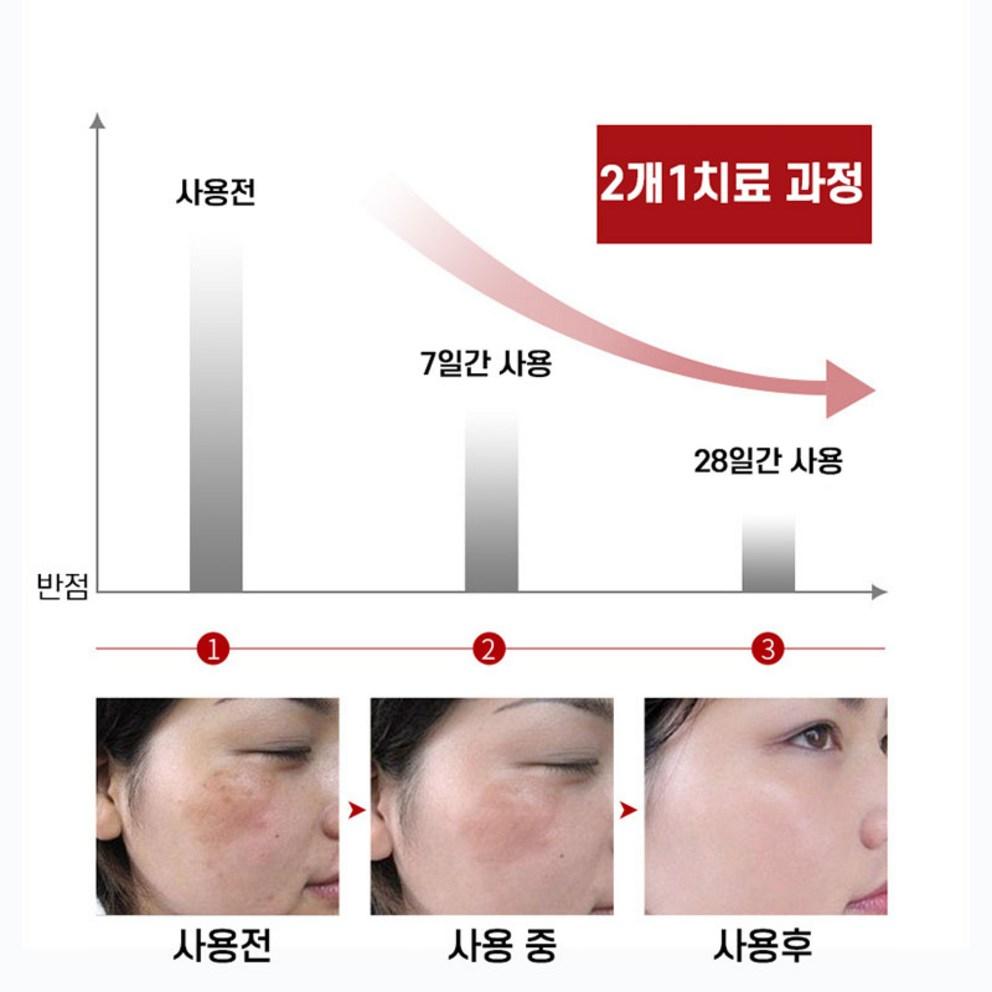 [Melanon] Cream, Hahm Ik-byung Blemish Cream, Blemish, Freckle, Dark Spot Remover, Whitening Cream, Pigmentation Cream, 20.01g, 4pcs