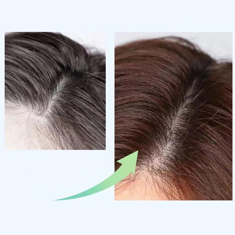 Новый шампунь с солью и имбирем из центеллы азиатской, скраб для зуда кожи головы, питательный уход за кожей головы, шампунь для гладких волос