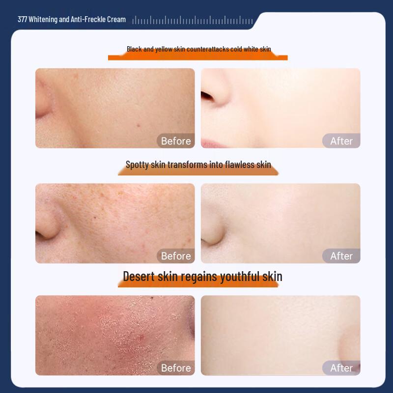 Крем для лица Yuranmei 377 для отбеливания и осветления пигментных пятен