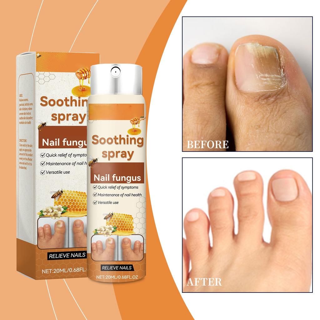 Средство для ногтей питает, восстанавливает и улучшает внешний вид ногтей. Раствор для ежедневного ухода 20 мл