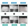 10Pcs/Box Forehead Line Removal Anti-wrinkle Stickers Frown Lines Treatment Anti-aging Lifting Mask Moisturizng Patch Skin Care Facial Pad