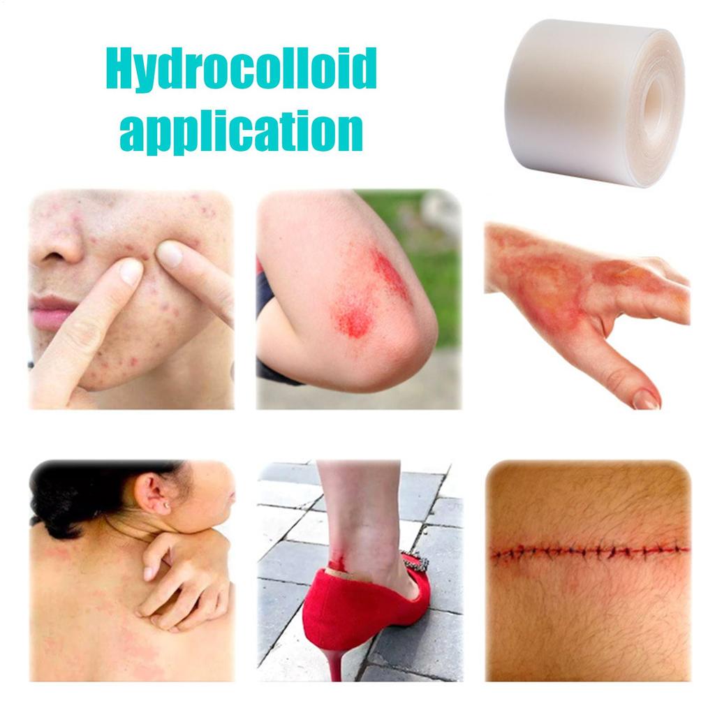 Hydrocolloid Bandages Hydrocolloid Dressing Moist Patch Flexible Breathable Bandages for Toe Face Pimple Cuts Burn Wound Care