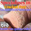 Soothing Natural Ointment for Cracked Hands Feet - Moisturizing & Safe