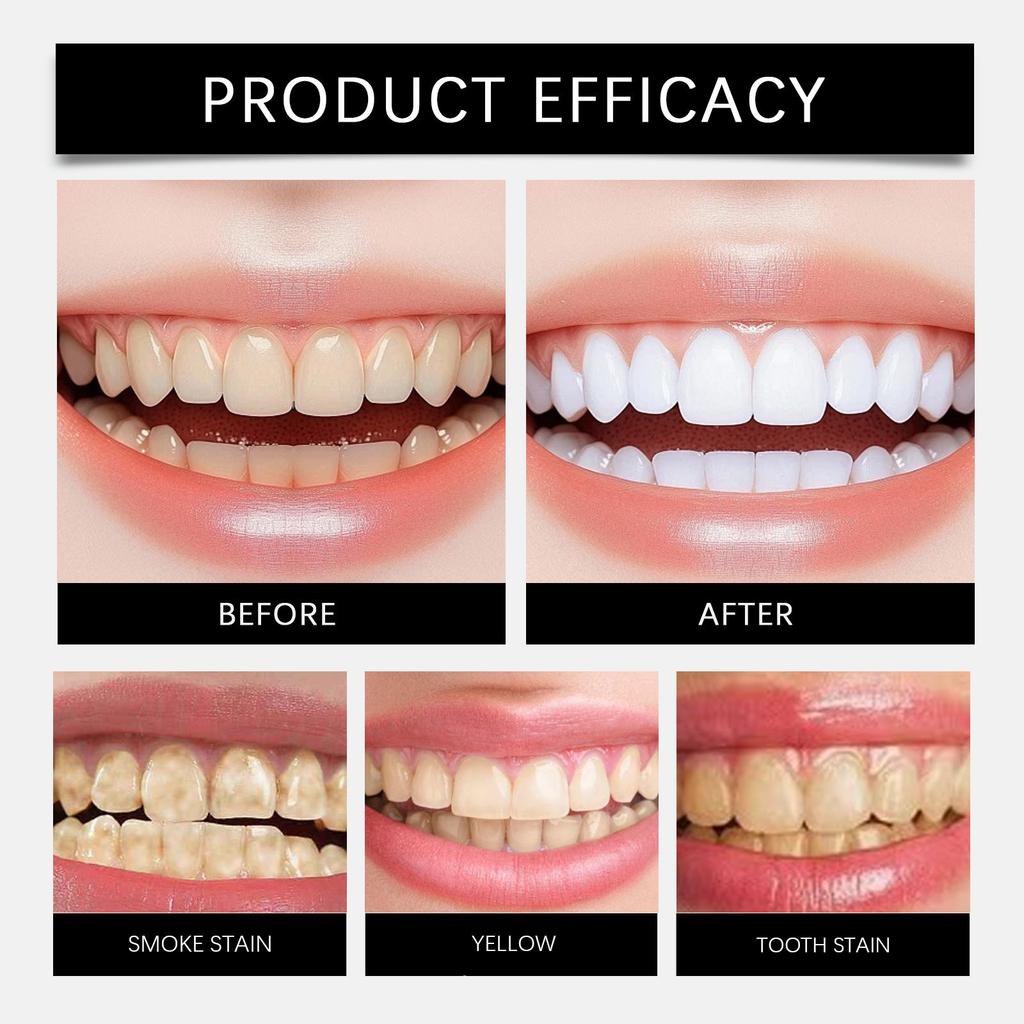 SP10 Probiotics Ultra Whitening Toothpaste Tooth Stain Removal Toothpaste For Oral Caring
