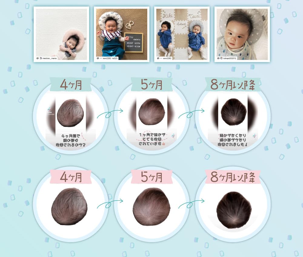 ESMERALDA Дышащий ребенок Предотвращение плоской головы Скользящий ребенок Может использоваться с новорожденных [Официальный Esmeralda] Подушка, Подушка, Подушка, (Белая Звезда)