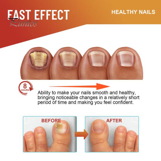 32/64/96 шт./упаковка пластыри для ухода за пальцами ног безопасные нежные средство от грибка ногтей улучшают внешний вид ногтей укрепляют ногти ночные пластыри от грибка ногтей