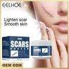 Scar Removal Cream Acne Scars Gel Stretch Marks Surgical Scar Burn for Body Pigmentation Corrector Acne Spots Repair Care