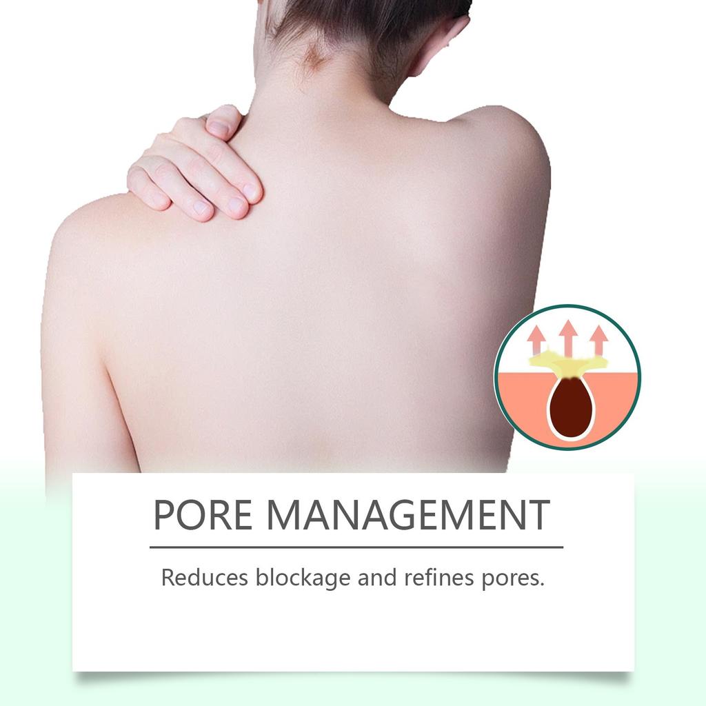 Спрей для ухода за кожей спины Разглаживающий, Осветляющий, Сужающий поры и Мягкий спрей для ухода за кожей, склонной к акне 100 мл