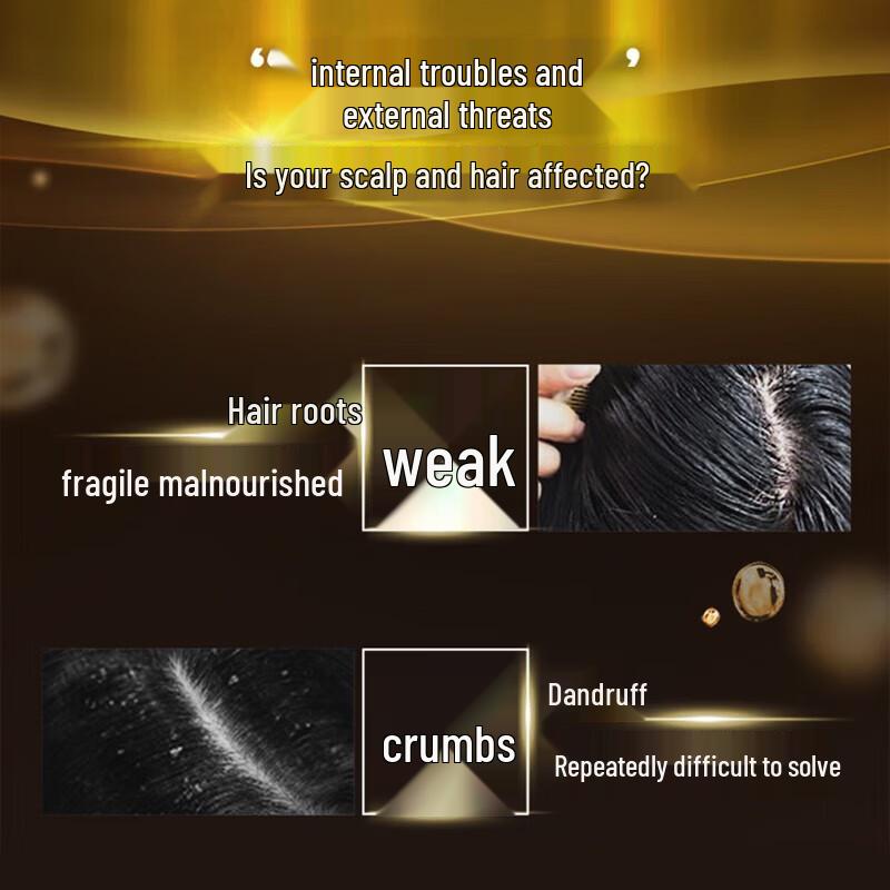 Clear Anti-Dandruff & Scalp Care Shampoo - 6x650g Bulk Pack