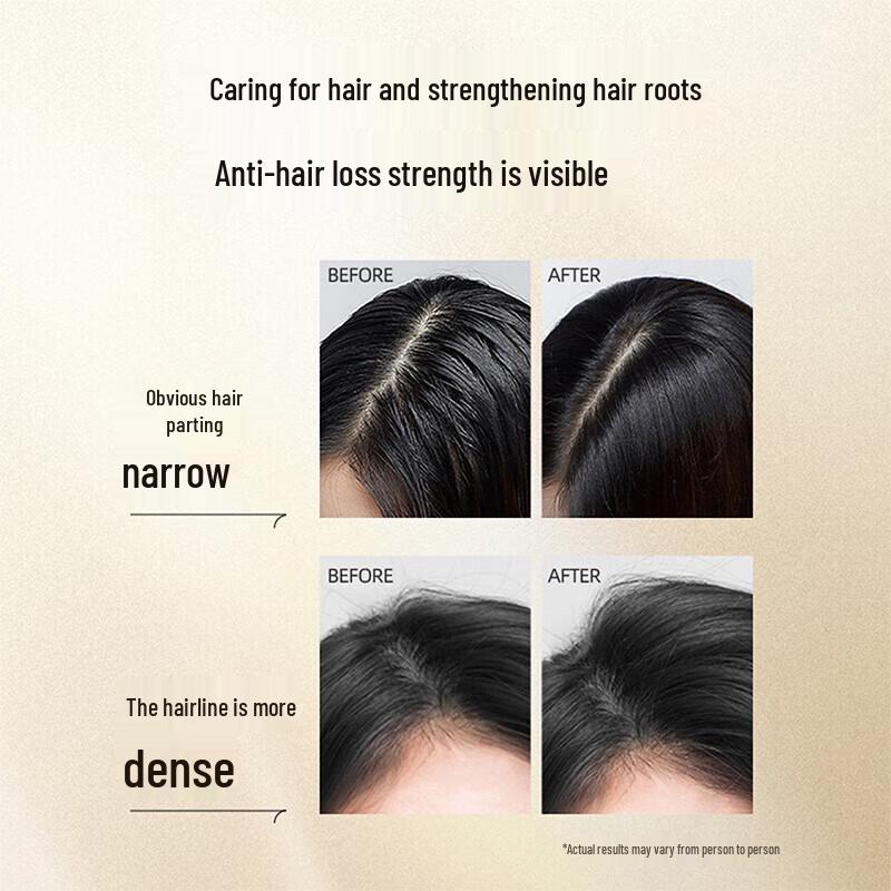 Yangyuanqing Anti-Hair Loss & Strengthening Shampoo