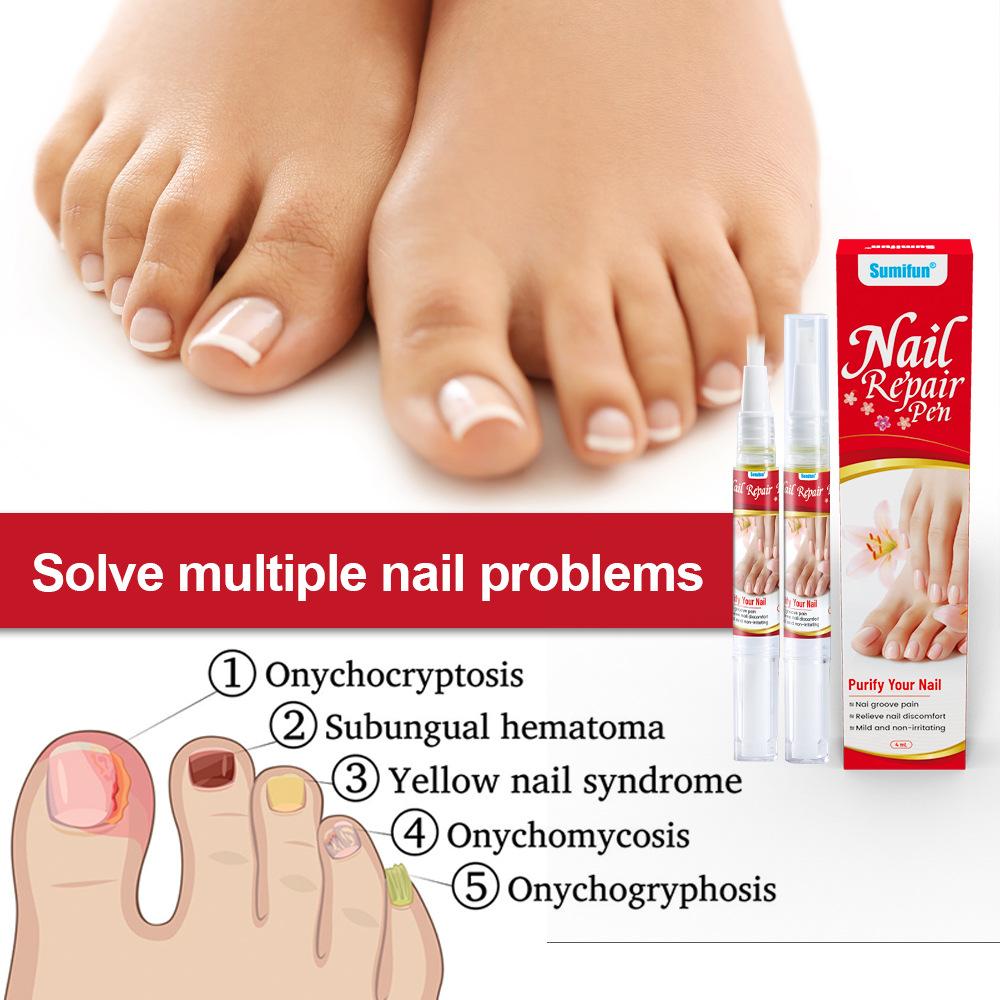 Средство для лечения грибка ногтей, поврежденных и изменивших цвет ногтей 4 мл