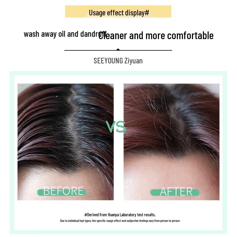ZIYUAN Silicone-Free Oil Control Anti-Dandruff Shampoo