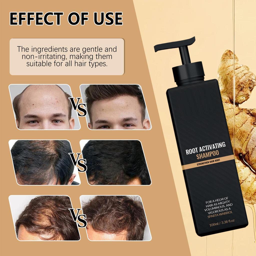 Hair Loss Treatment Shampoo Promotes Growth, Strengthens Roots, Repairs Scalp, Anti-Thinning